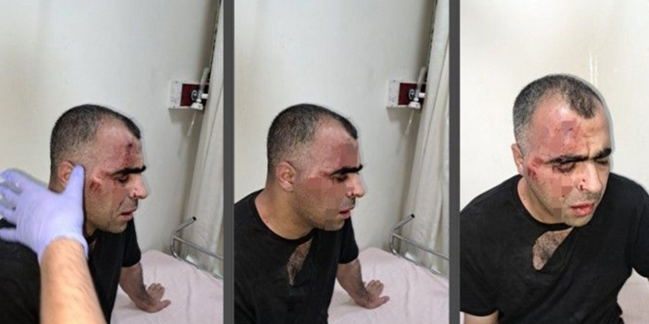 Belediye çalışanı gazeteciyi darbetti! O anlar güvenlik kamerasına böyle yansıdı