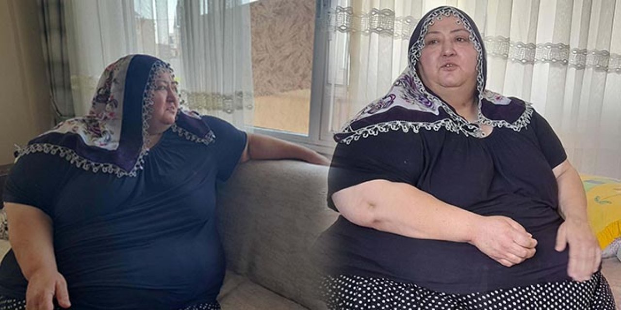 Fil hastası kadın 7 yıldır evden çıkamıyor