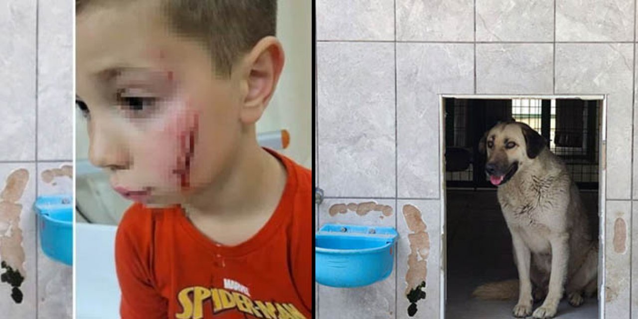 Bursa'da sokak köpeği bir çocuğun yüzünü parçaladı!