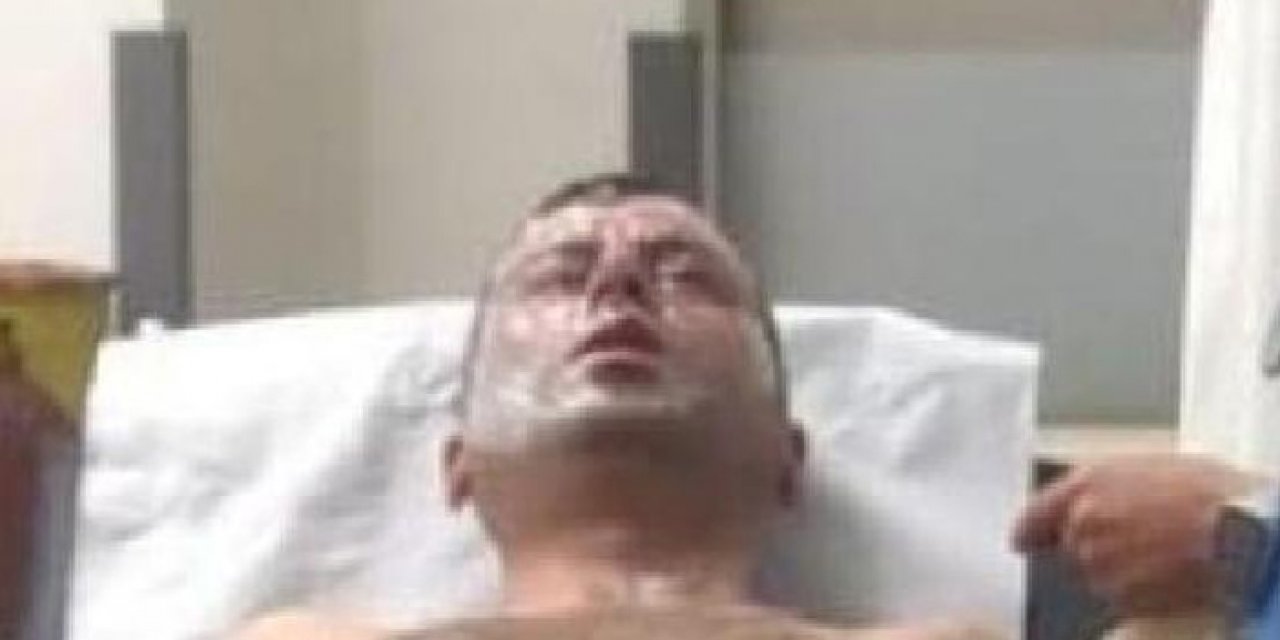 Temizlik yaparken dikkat: Neye uğradığını şaşırdı