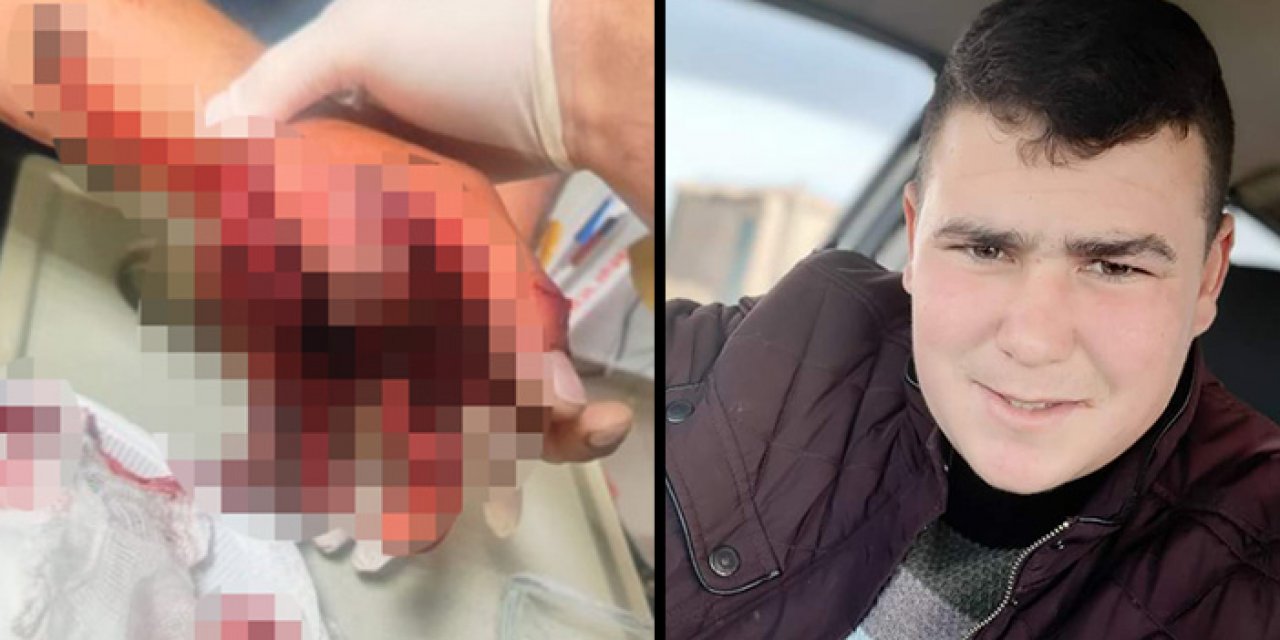 Bir havai fişek vakası daha; elinde patladı!