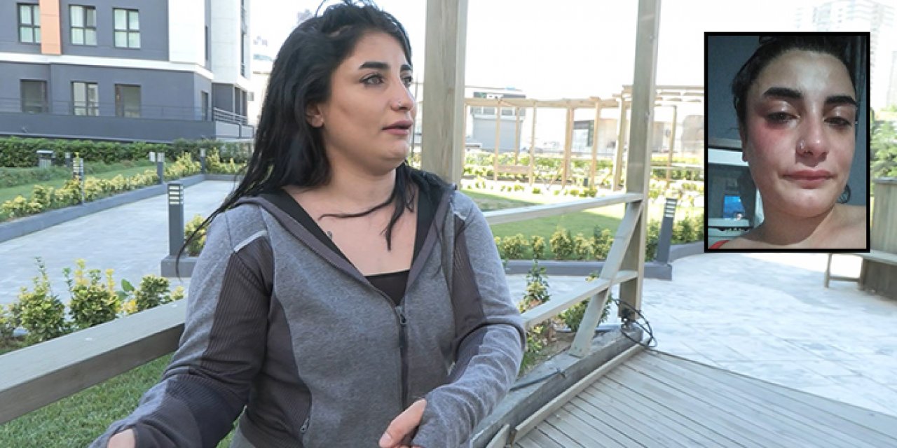 Markete köpeği ile girmek isteyen hamile kadın darbedildi: Düşük yaptı