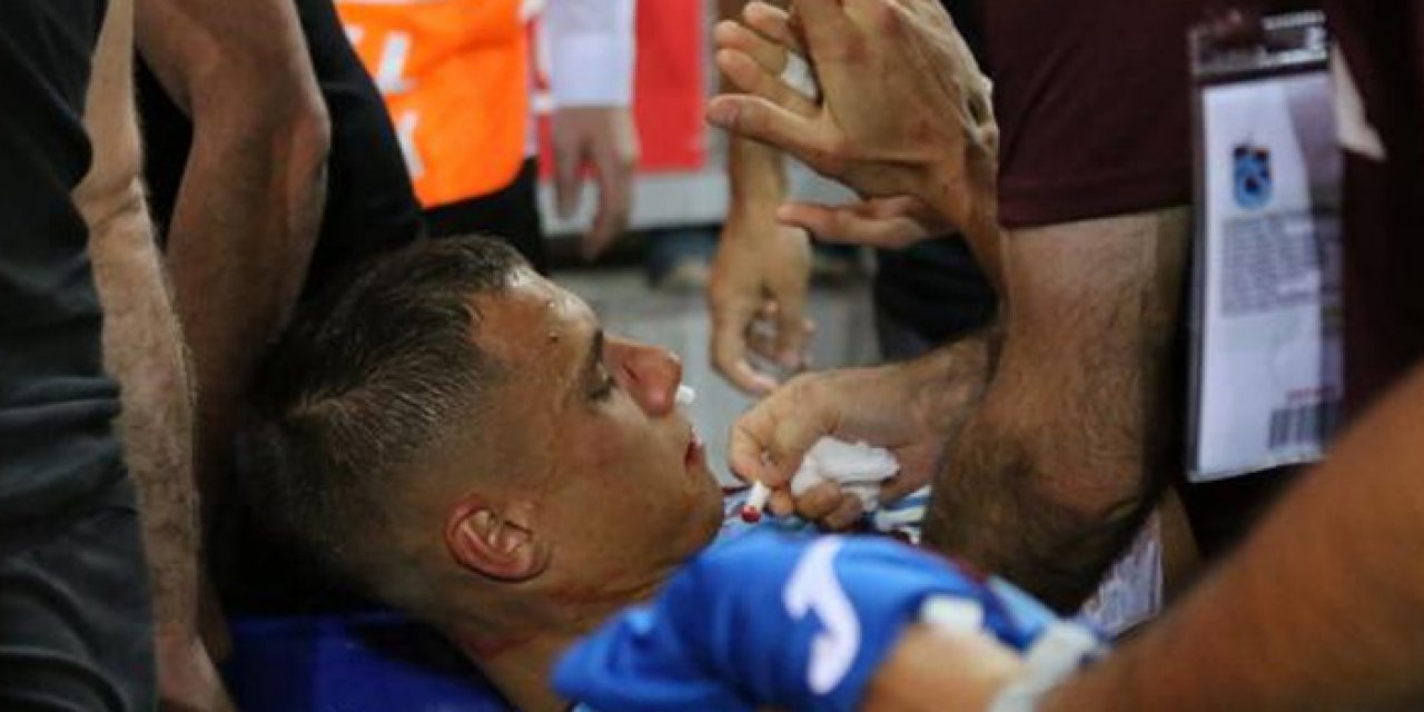Trabzonsporlu Benkovic'in burnunun kırıldığı açıklandı