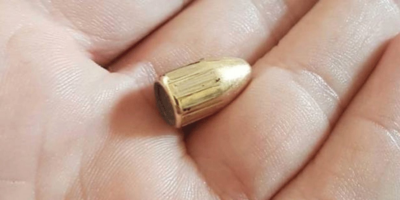 3 yaşındaki çocuğun başına yorgun mermi isabet etti