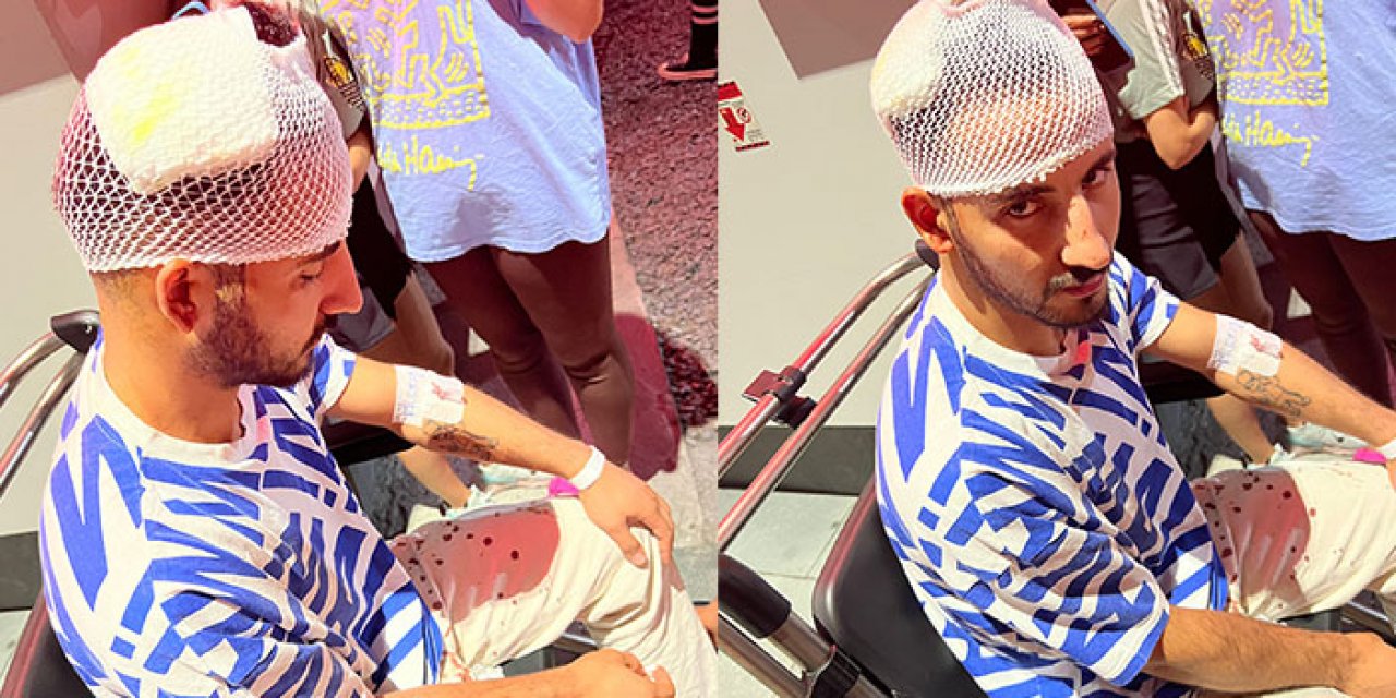 Alev alan tüpü balkondan attılar; sürücünün kafasına düştü