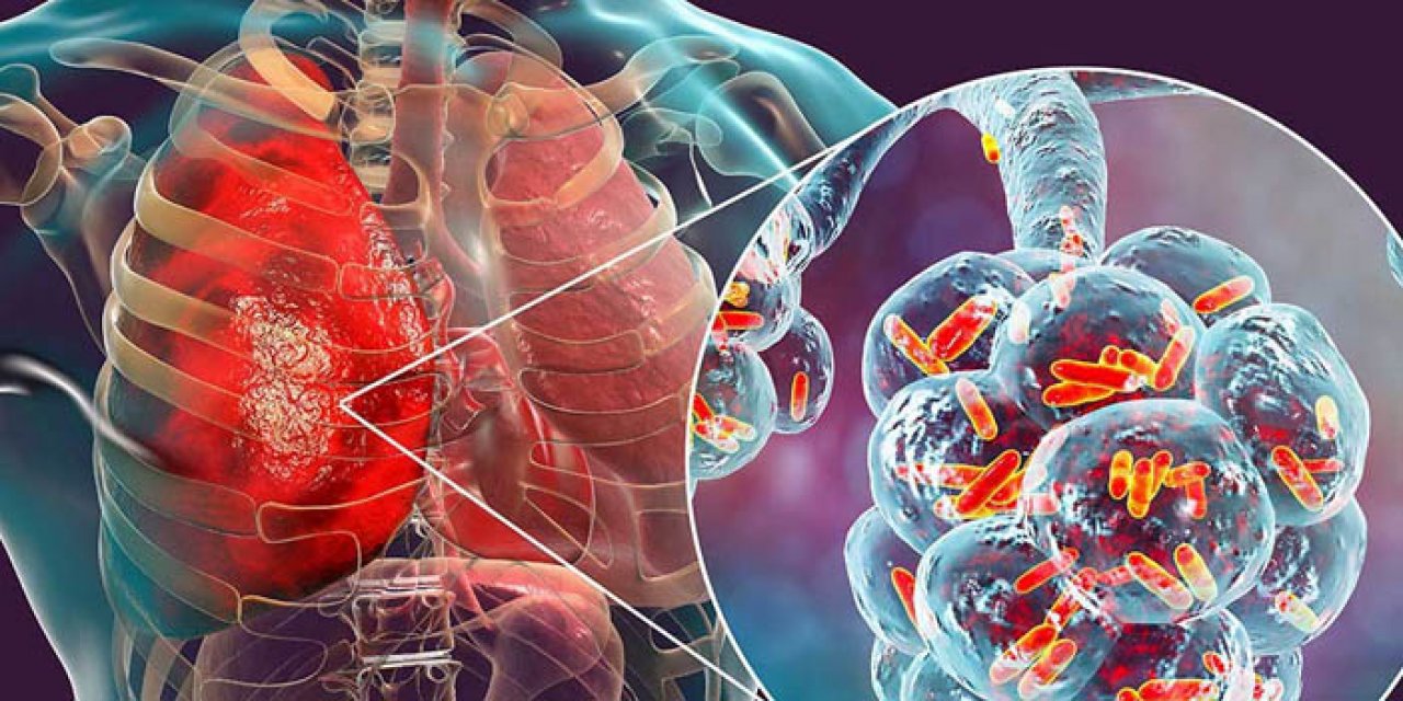 Dünya teyakkuzda: Sars, Ebola, Korona virüsü derken bir yenisi daha çıktı