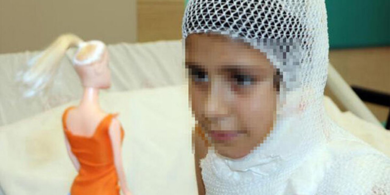 Sosyal medyadaki kolonya yakma videosu canından ediyordu