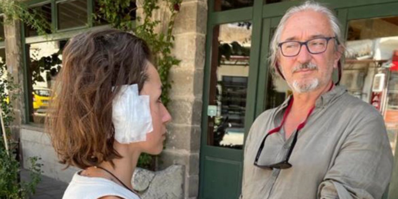 Sokak köpekleri 2 turisti yaraladı