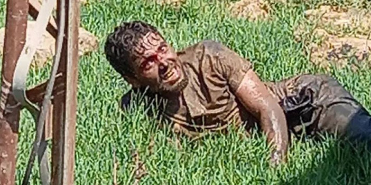 Şanlıurfa'ya getirilmişti: Suriyeli kuduz hastası hayatını kaybetti