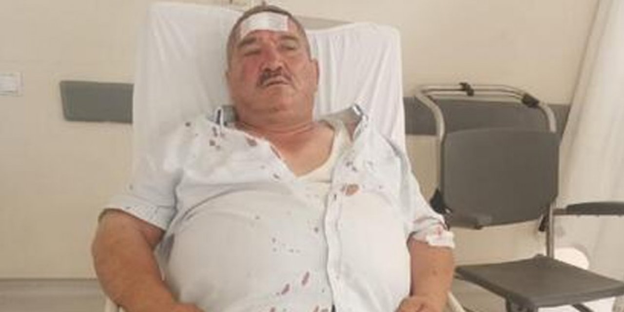 ‘Neden korna çalıyorsun’ kavgası