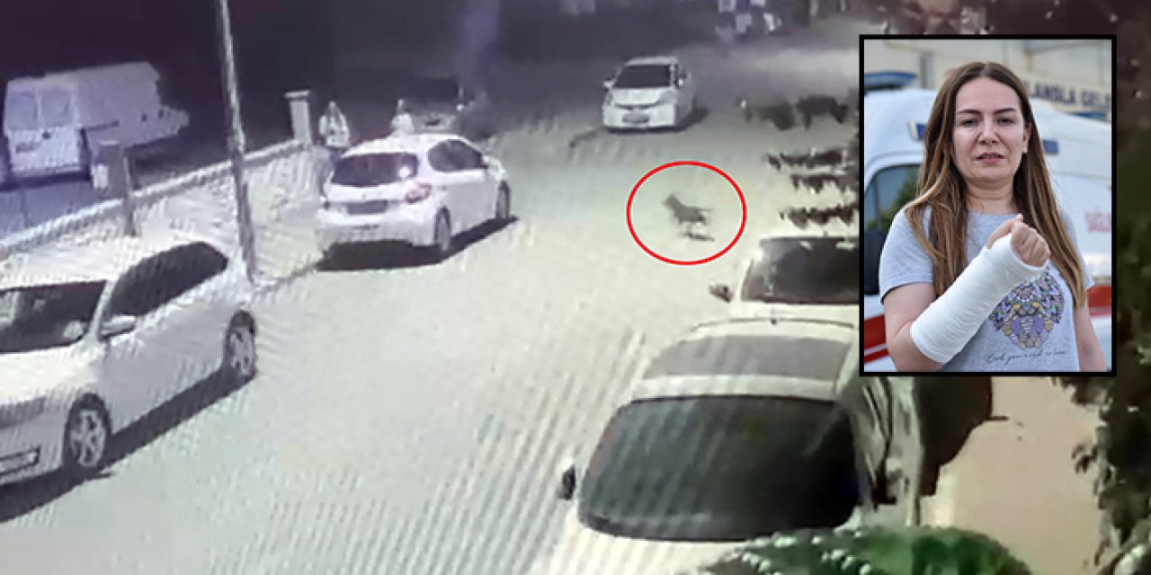 Başıboş Pitbull dehşeti devam ediyor: Köpeğini kurtarmak isterken bileği kırıldı