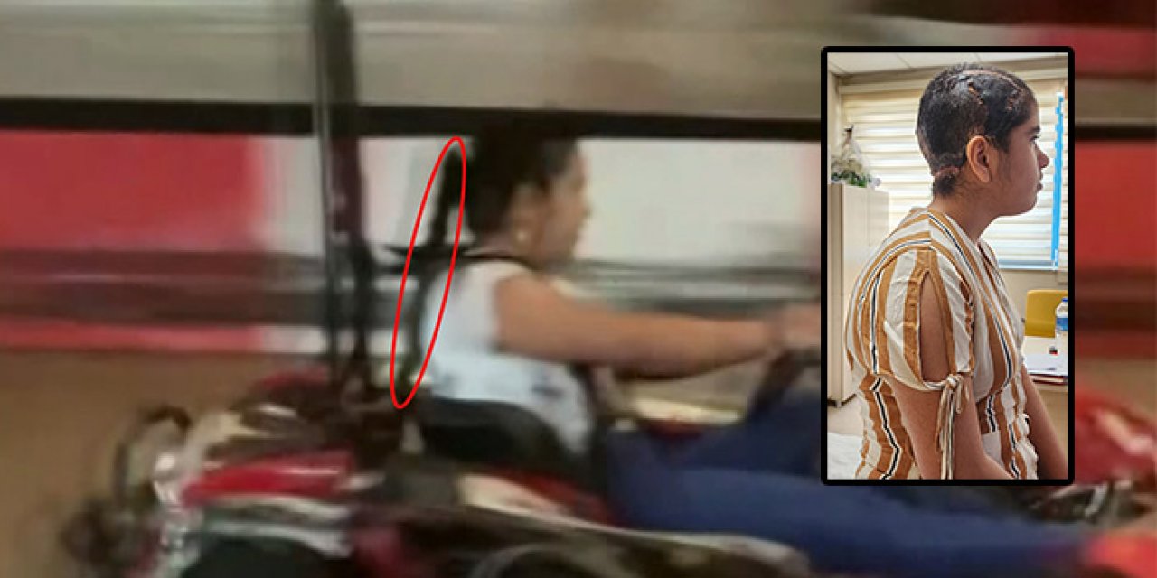 Go-Kart aracına saçını kaptıran genç ölümden döndü!