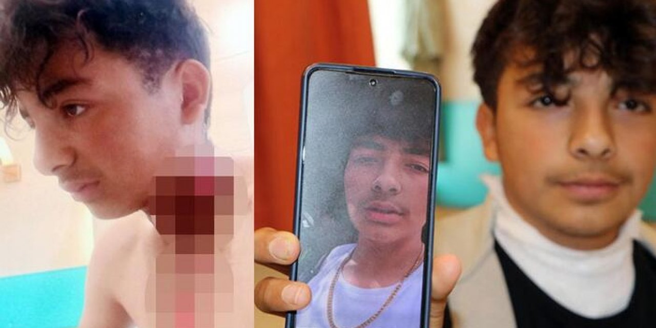 Boynundaki kolyeye yıldırım düştü