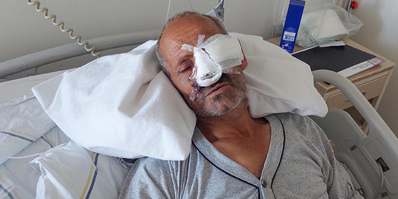 Elektrikli testere yüzüne çarptı: Gözünü kaybedebilir