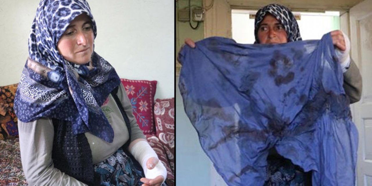 Hayvanların otlatılması yüzünden saldırıya uğradı