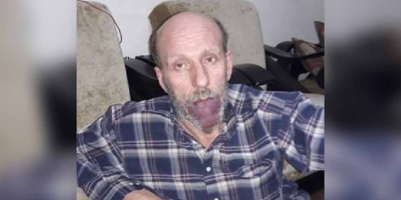 Fabrikanın havalandırma borusunda patlama: 1 ölü, 1 yaralı