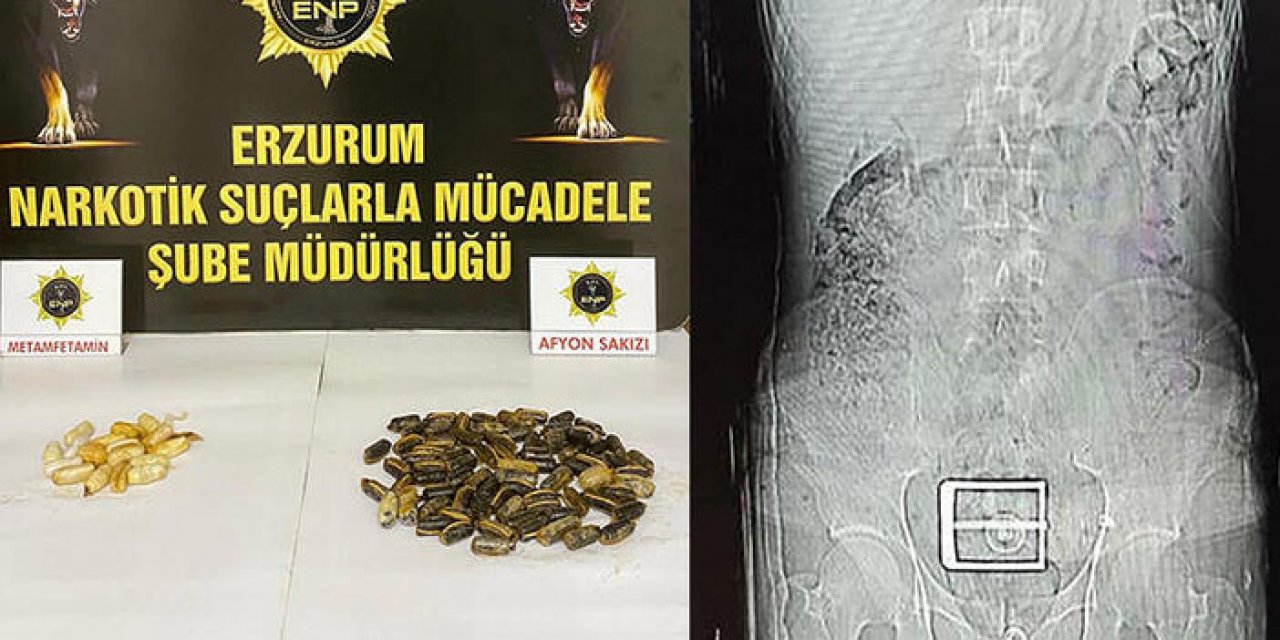 Mide ve bağırsağından uyuşturucu çıktı