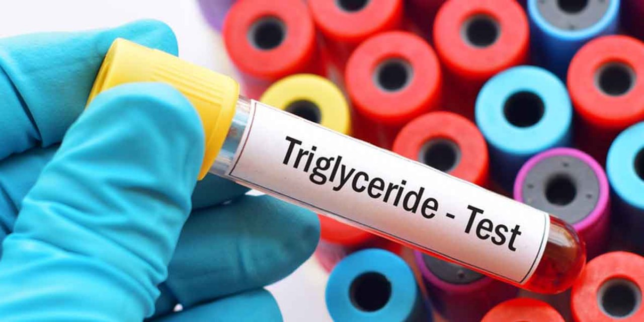 Trigliserid Nedir? Trigliserid Değeri Kaç Olmalı? Trigliserid Normal Değeri Kaç?
