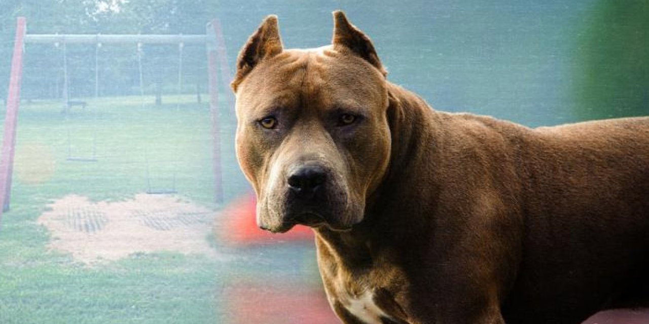 Pitbull’un saldırdığı kadının bacağı kesilmişti: Köpek sahibine dava açıldı