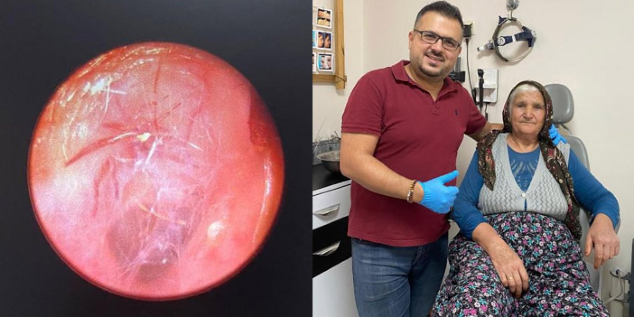 Ses şikayetiyle hastaneye gitti; kulağındaki şoke etti