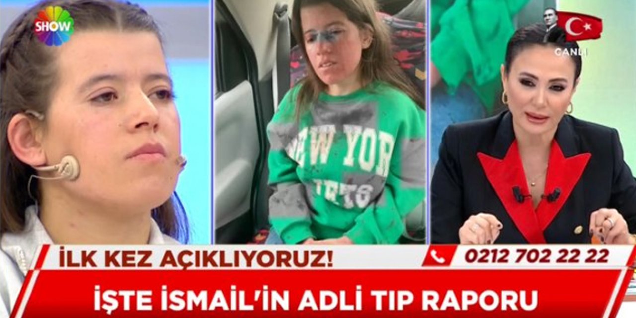 Manisa’da şüpheli ölüm! Otopsi raporu kan dondurdu