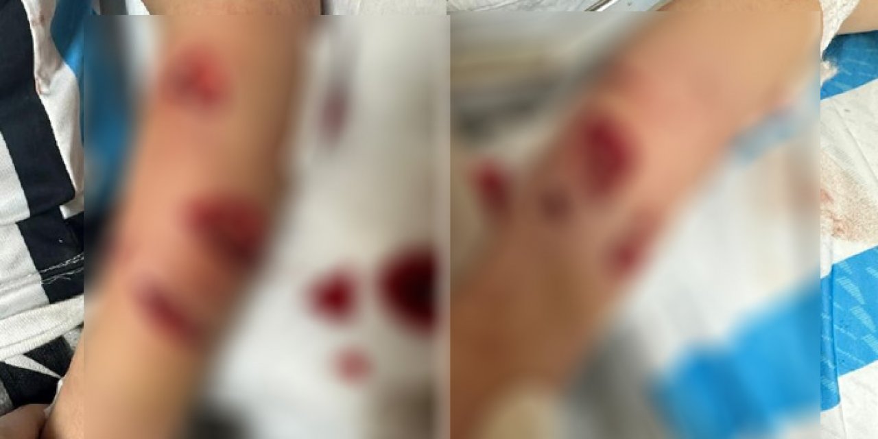 Köpek terörü bitmiyor: 12 yaşındaki çocuğu parçaladılar