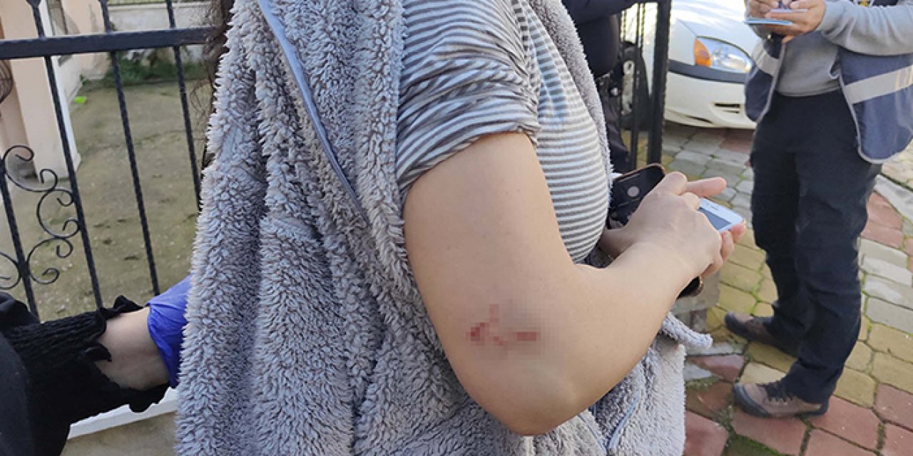 Pitbull saldırısına uğrayan kadın yaralandı