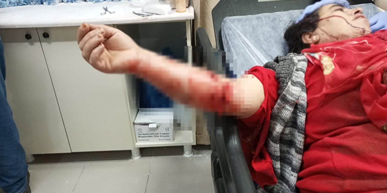 Bir köpek dehşeti daha! Yasaklı ırk saldırısına uğrayan kadın yaralandı