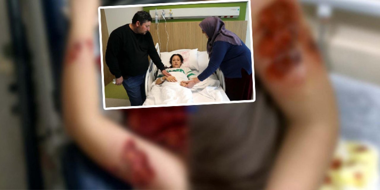 Şanlıurfa'da vahşet: Sokak köpeği 12 yaşındaki Fidan'ı yaraladı