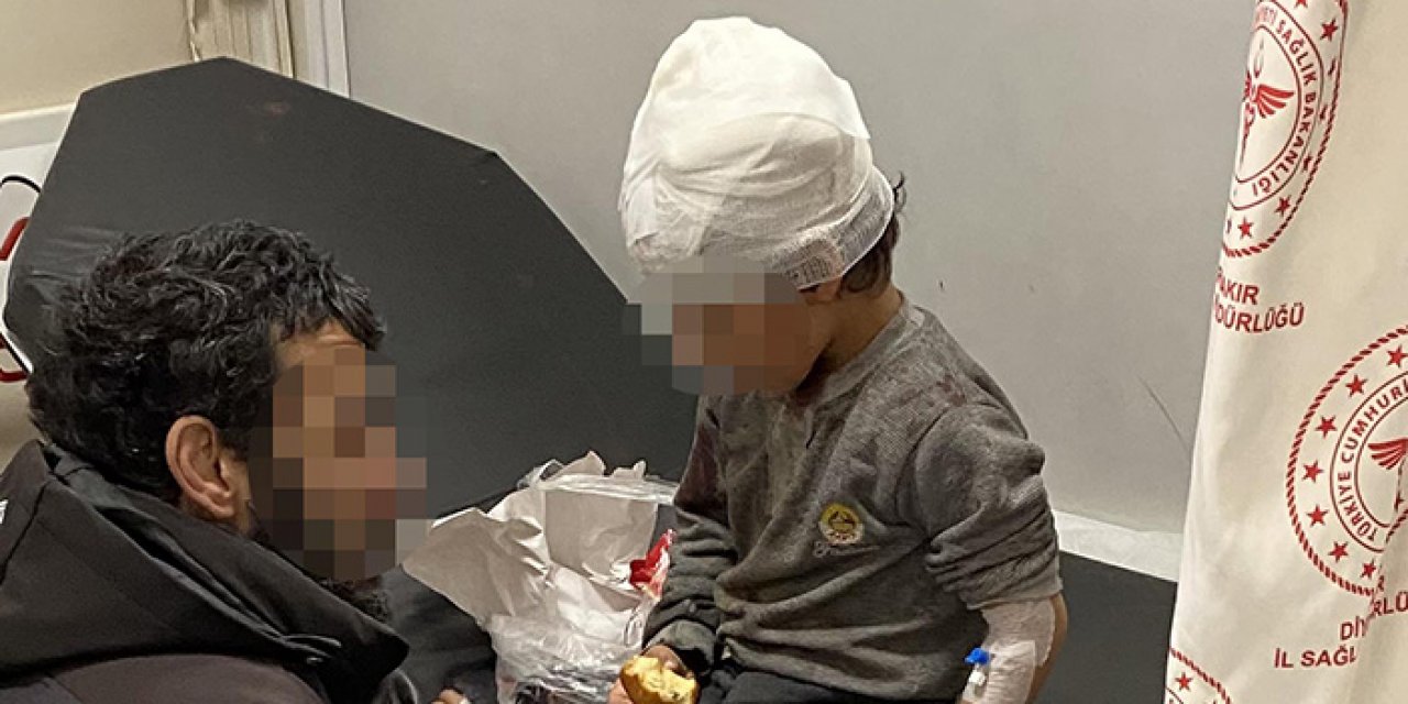 Köpek terörü bitmek bilmiyor! 5 yaşındaki çocuk başından yaralandı