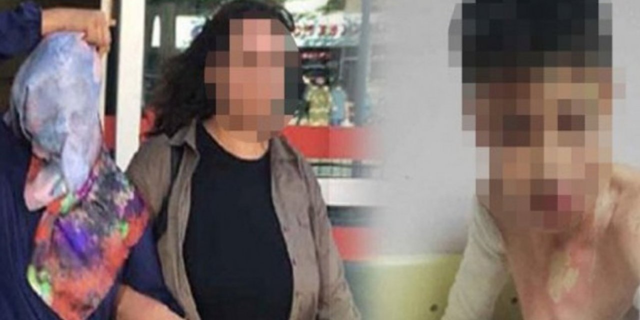 Konya'da facia! Komşularına kezzap attı: 8 yıl ceza aldı