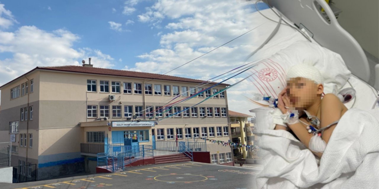 Okulda düşüp beyin kanaması geçirdi! Bakanlık soruşturma başlattı