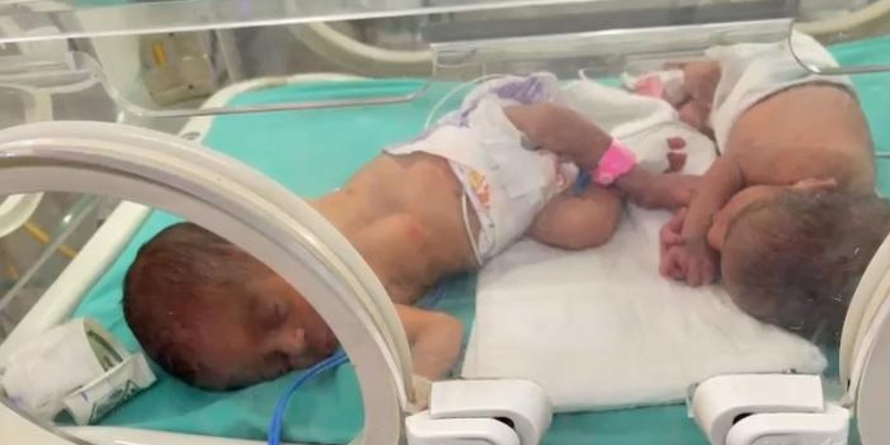 Gazze'de iki bebek açlıktan öldü