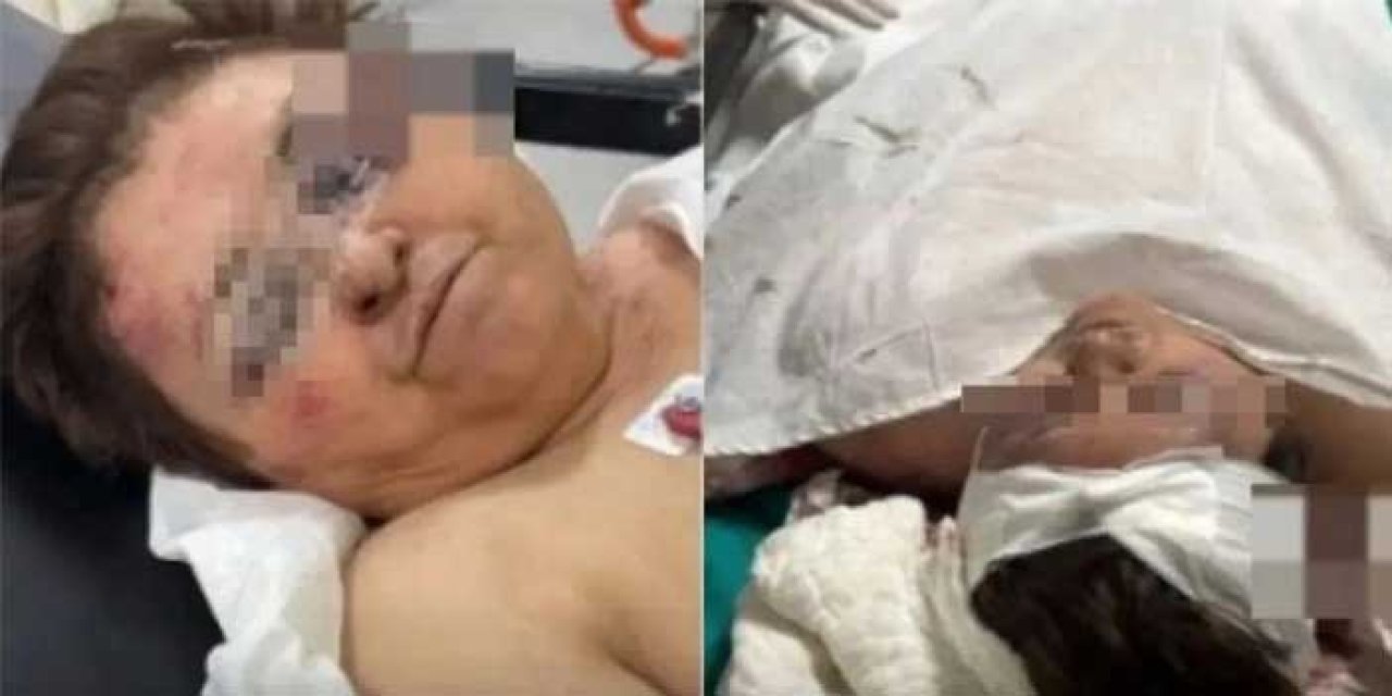 İzmir’de Kan Donduran Olay: Gelin, Kayınvalidesini Tuğlayla Ağır Yaraladı!