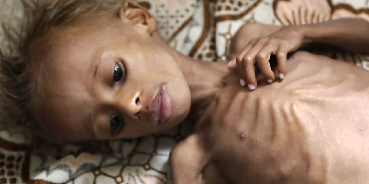 UNICEF: “Yemen’de çocukların yarısı yetersiz besleniyor”