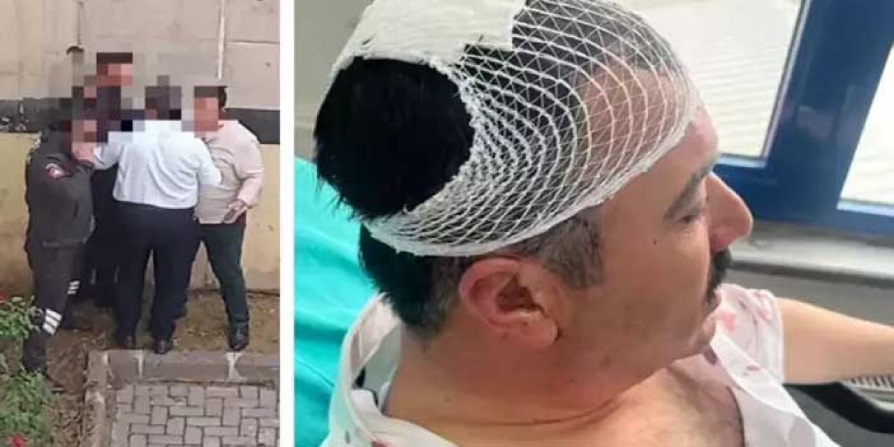 Yeniden Refah Partili başkan yardımcıları arasında kavga: Kafasını şekerlikle parçaladı