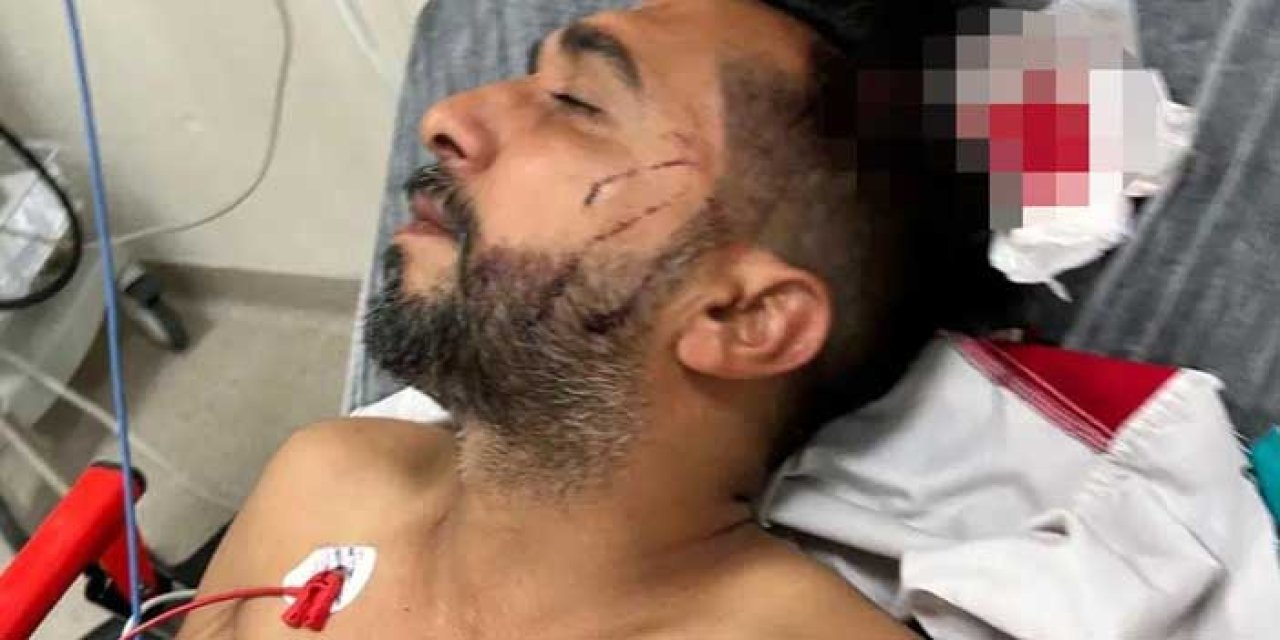Şok olay: Dönercide dürüm yerken başından vuruldu