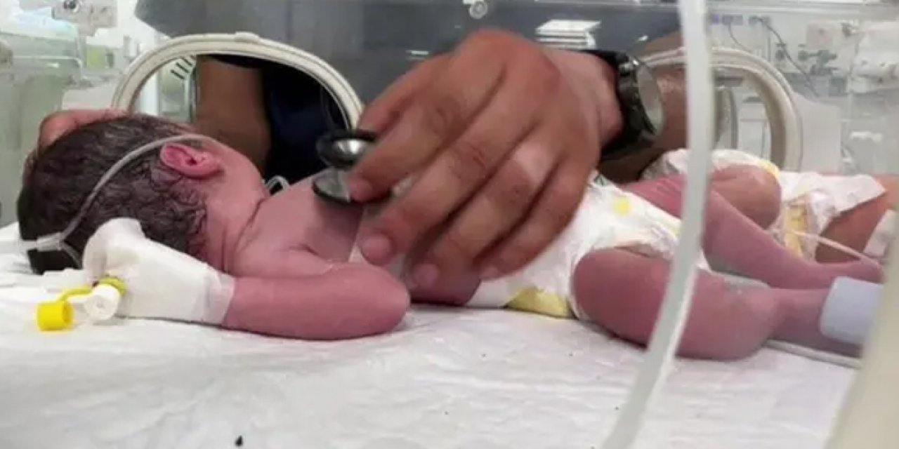 Gazze'de beslenme yetersizliği nedeniyle iki bebek hayatını kaybetti