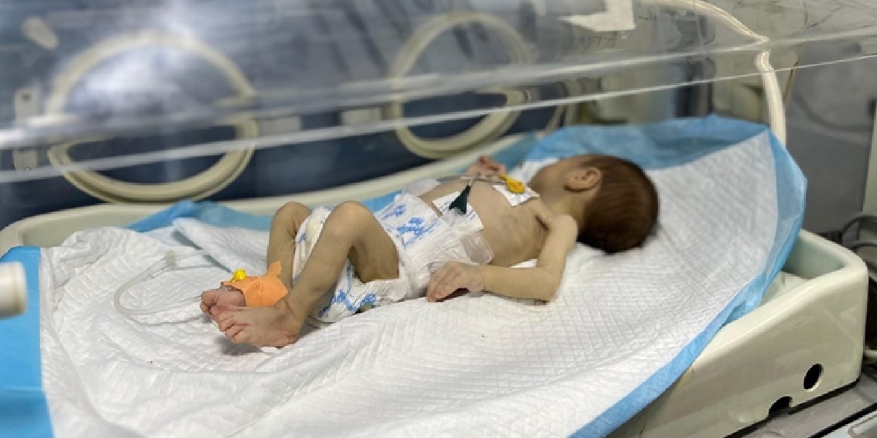 Gazze’de gıda krizi derinleşiyor: 66 çocuk açlıktan hayatını kaybetti