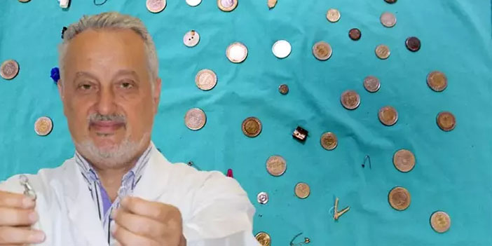 Yutulan eşyaları koleksiyon yapan doktor