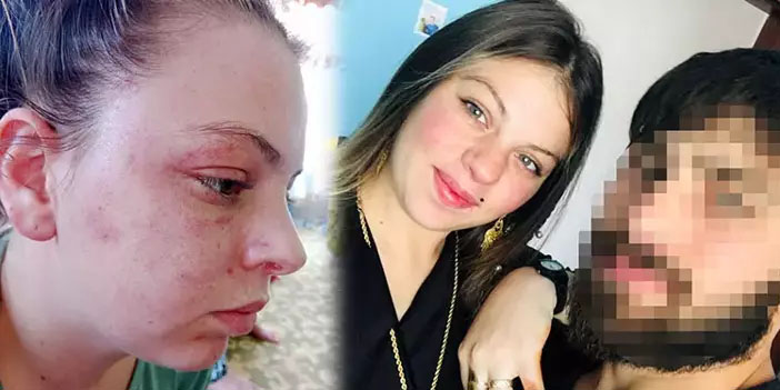 Milli sporcu eşinden şiddet gören genç kadın: “Birkaç saniye daha sıksaydı, ölebilirdim”