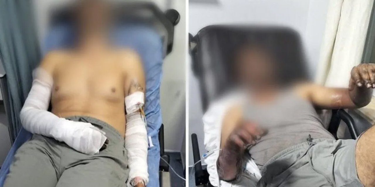 Manisa Salihli’de Sanayi Sitesinde Patlama: İki İşçi Yaralandı