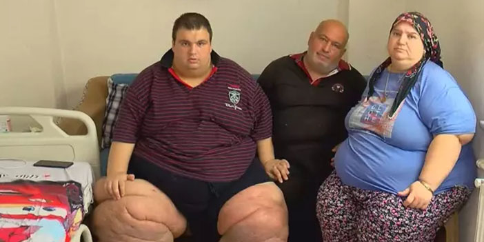 Lenfödem hastası Mehmet’in dramı: 270 kiloya ulaştı, 15 aydır evden çıkamıyor