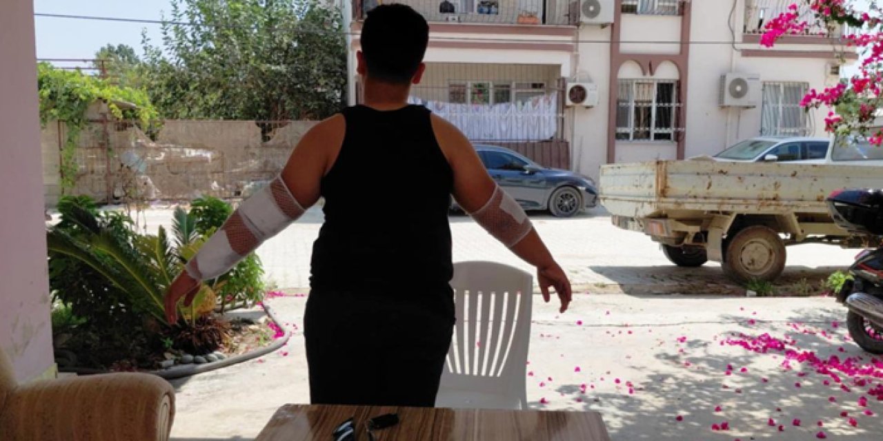 Hatay’da başıboş köpeğin saldırısına uğrayan çocuk yaralandı