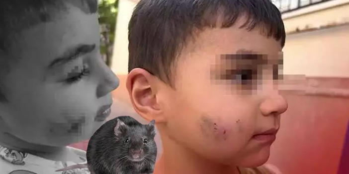 Sincan’da lağım faresi çocuğu ısırdı