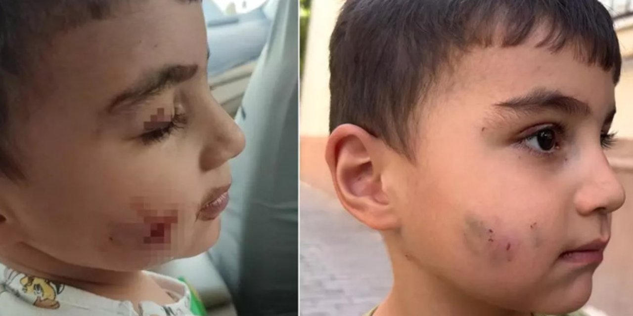 Ankara'nın göbeğinde lağım faresi uyuyan çocuğu ısırdı