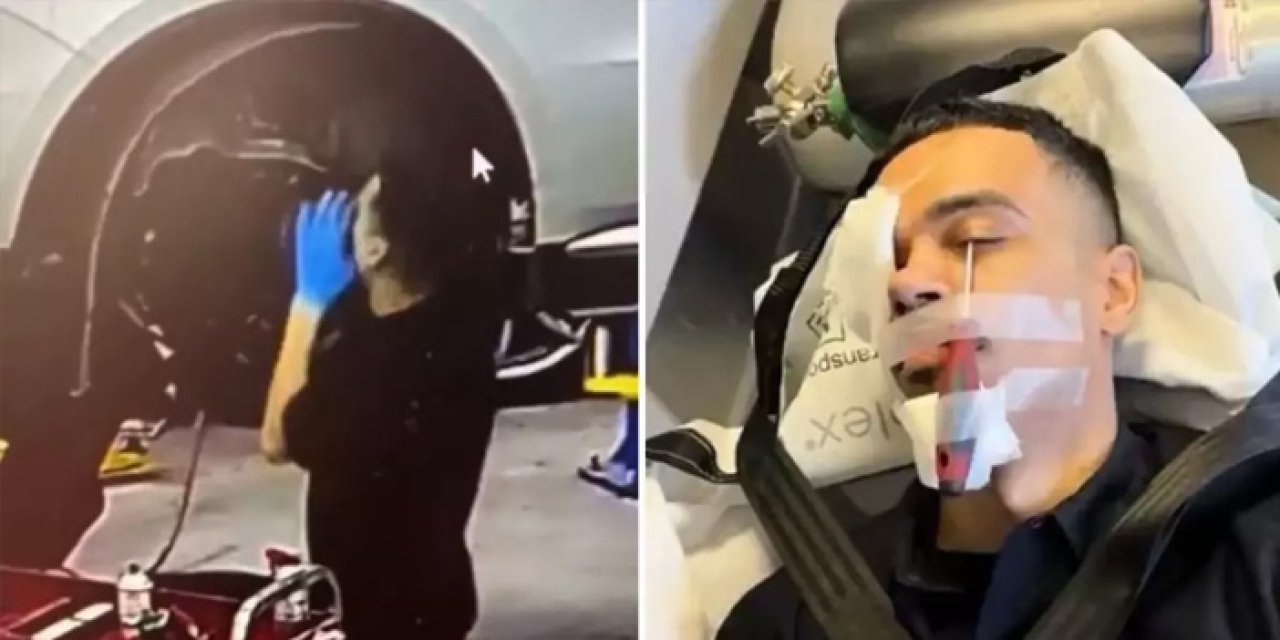 Otomobil tamirinde korkutan kaza! İşçinin gözüne tornavida saplandı