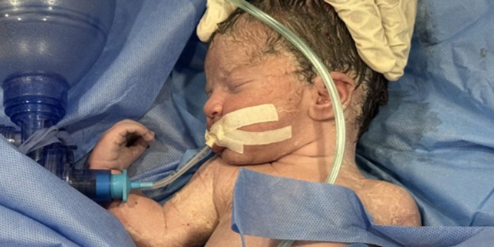 İsrail ateşi anne kucağındaki bebeği hayattan kopardı