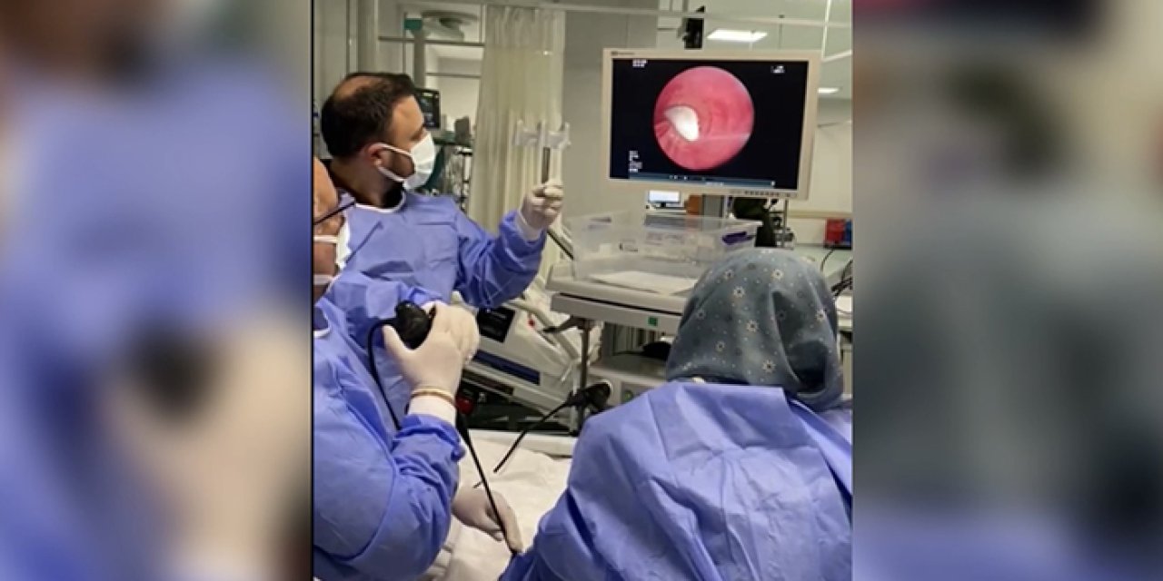 Nefes borusuna kaçan sarımsak ameliyatla çıkarıldı