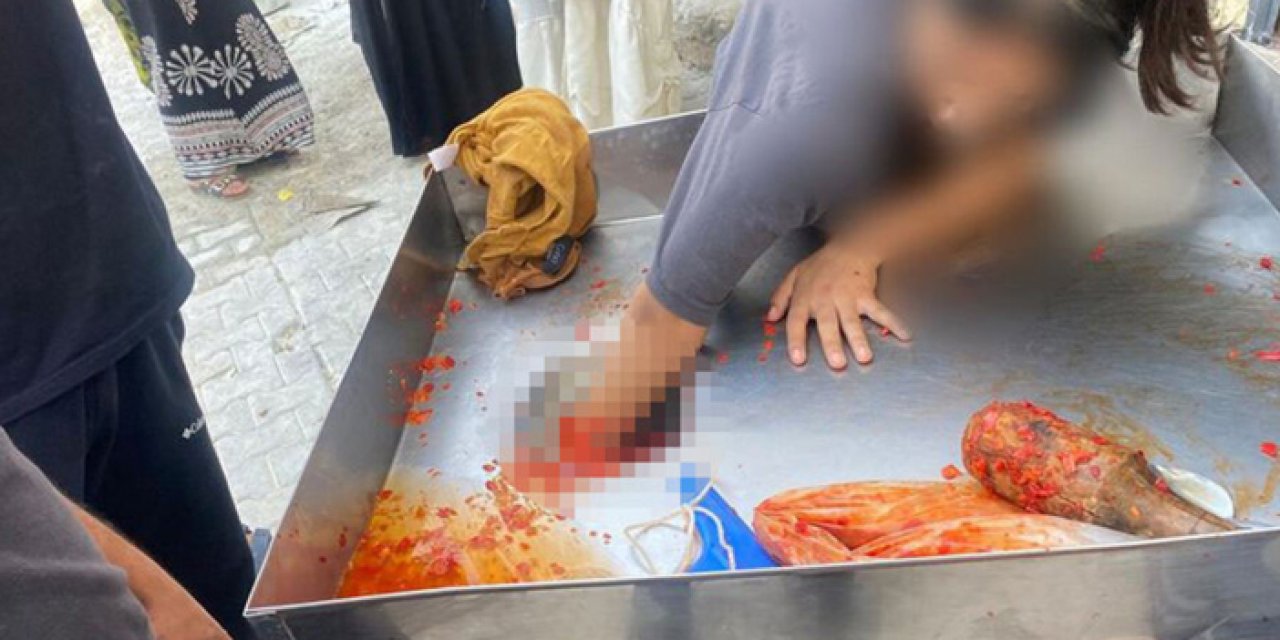 Elini salça makinesine kaptıran genç kız parmaklarını kaybetmekten kurtuldu